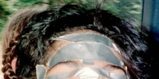 Botox: Pharma’s Answer to Duct Tape