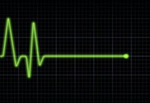 Weight Loss Drug Alli on Life Support. GSK Picks New Agency to Oversee Its Eventual Death