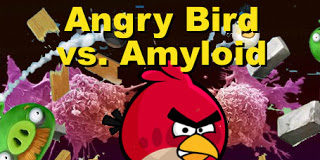 Pfizer and Janssen Halt Alzheimer Drug Development: Why Not Try Gamification?