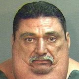 A New Unmet Medical Need: Excess Adipose Tissue Syndrome